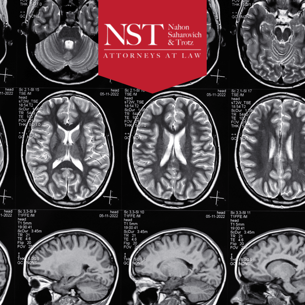 traumatic brain injury settlement