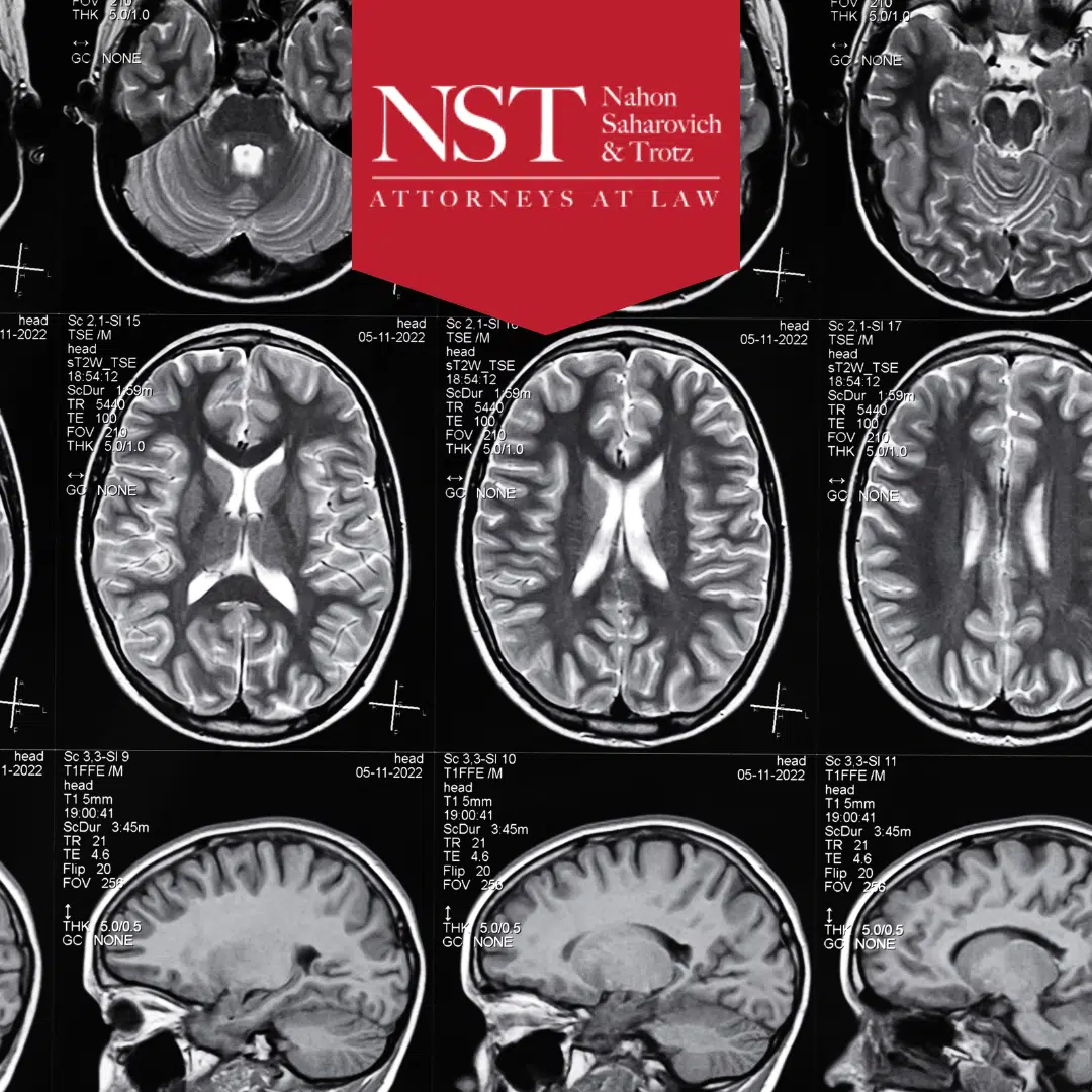 traumatic brain injury settlement